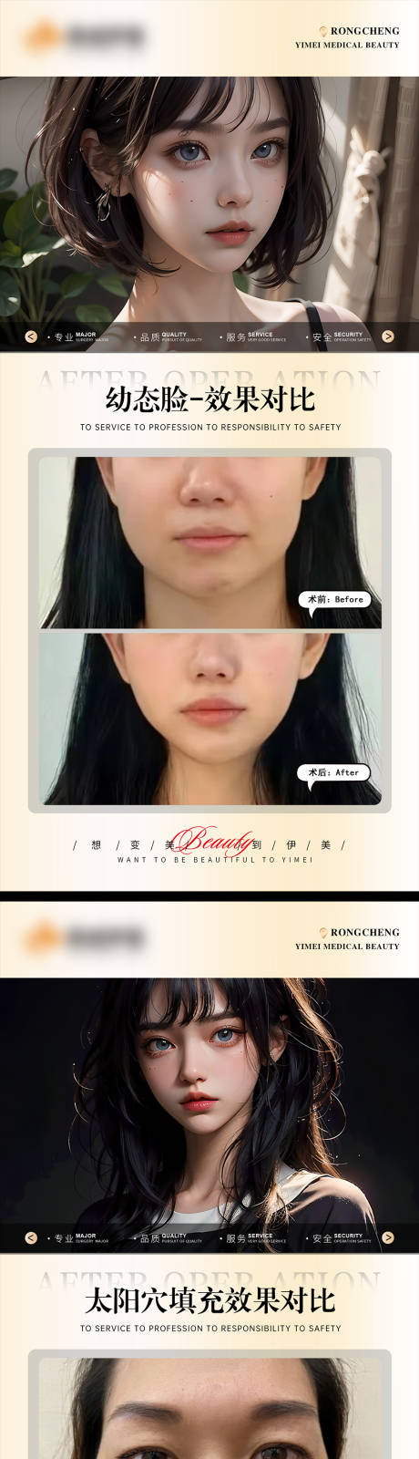 源文件下載【享設計】搜索編號：72800019996518351【醫美案例模板對比海報】