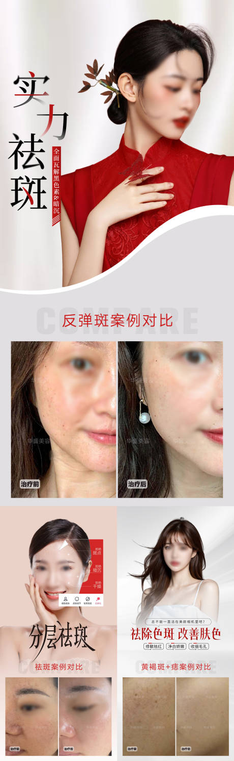 源文件下载【美业祛斑祛痣案例海报】编号：62240019748382025