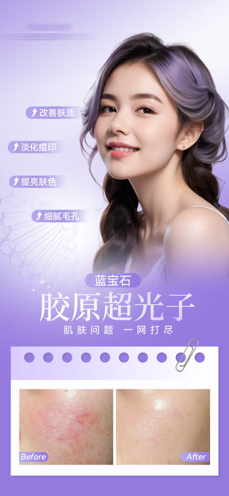 源文件下载【M22乔雅登超光子嫩肤案例海报】编号：94190020033504216