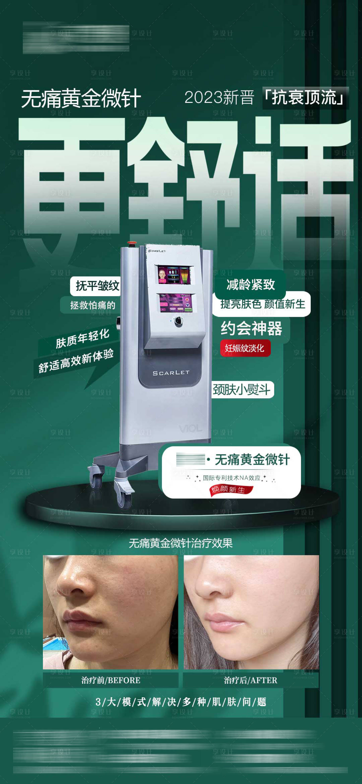 源文件下載【享設計】搜索編號：81090020027533093【醫美黃金超微針更有效簡約海報】