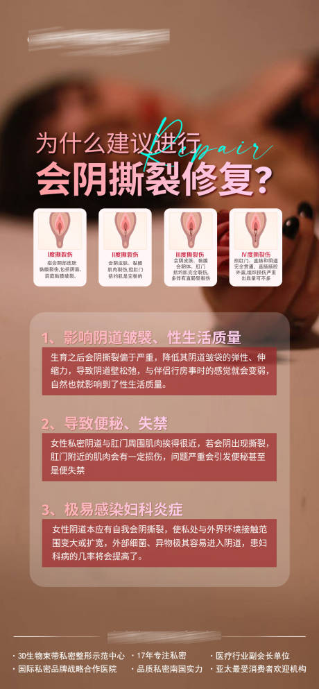 源文件下载【会阴撕裂修复】编号：13420019735774655