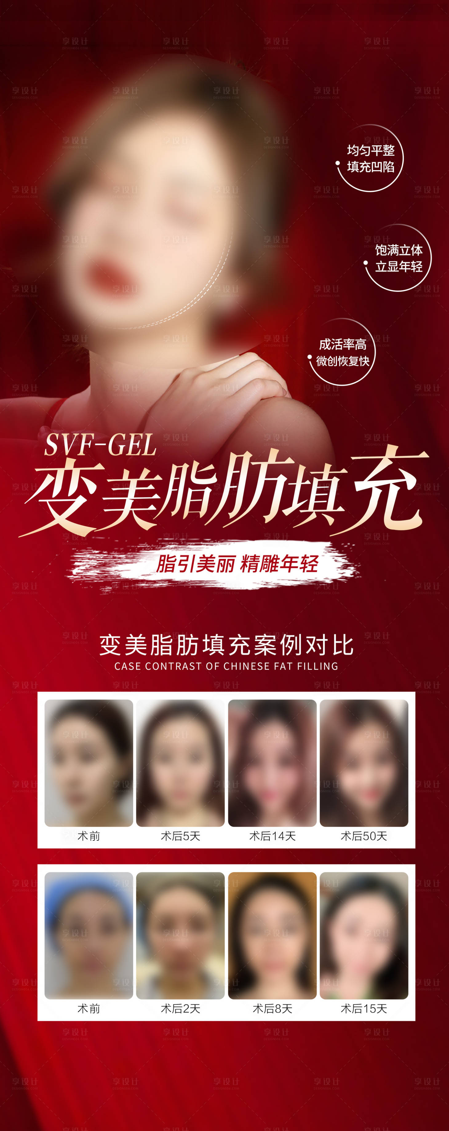 源文件下载【医美脂肪填充海报】编号：83450019642813012