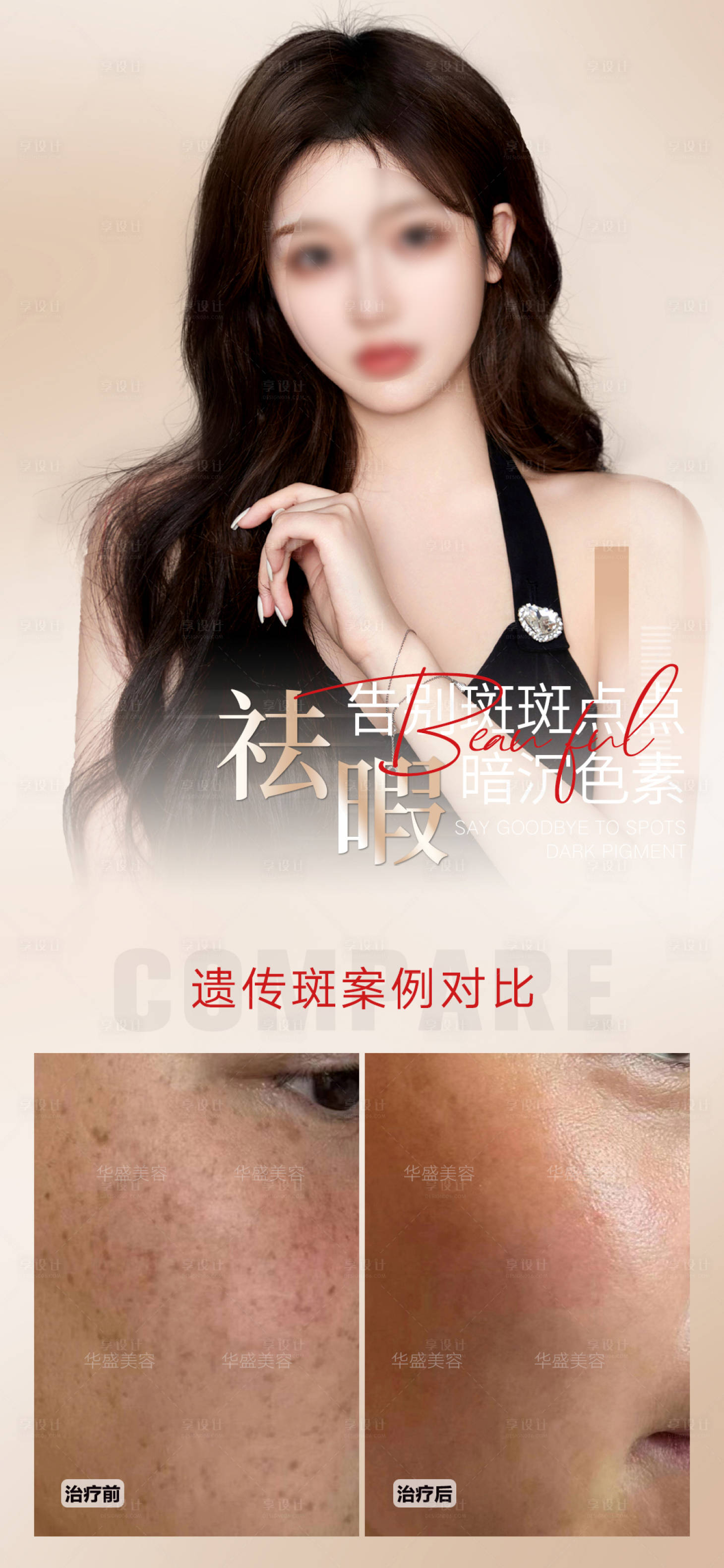 源文件下载【享设计】搜索编号：30890019834813436【医美祛斑美肤案例对比海报】