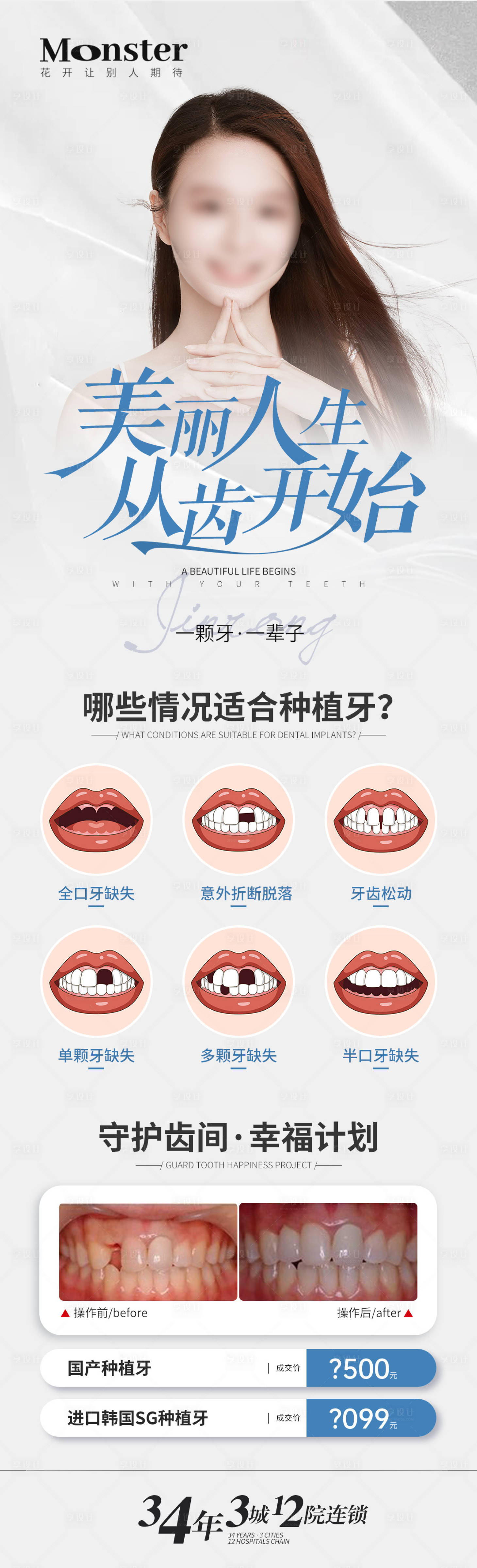 源文件下载【医美种植牙专题海报】编号：70360019858748392