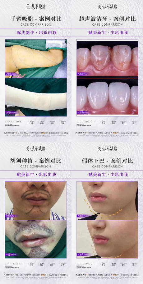 源文件下载【医美整形简约案例对比】编号：93670020027332013