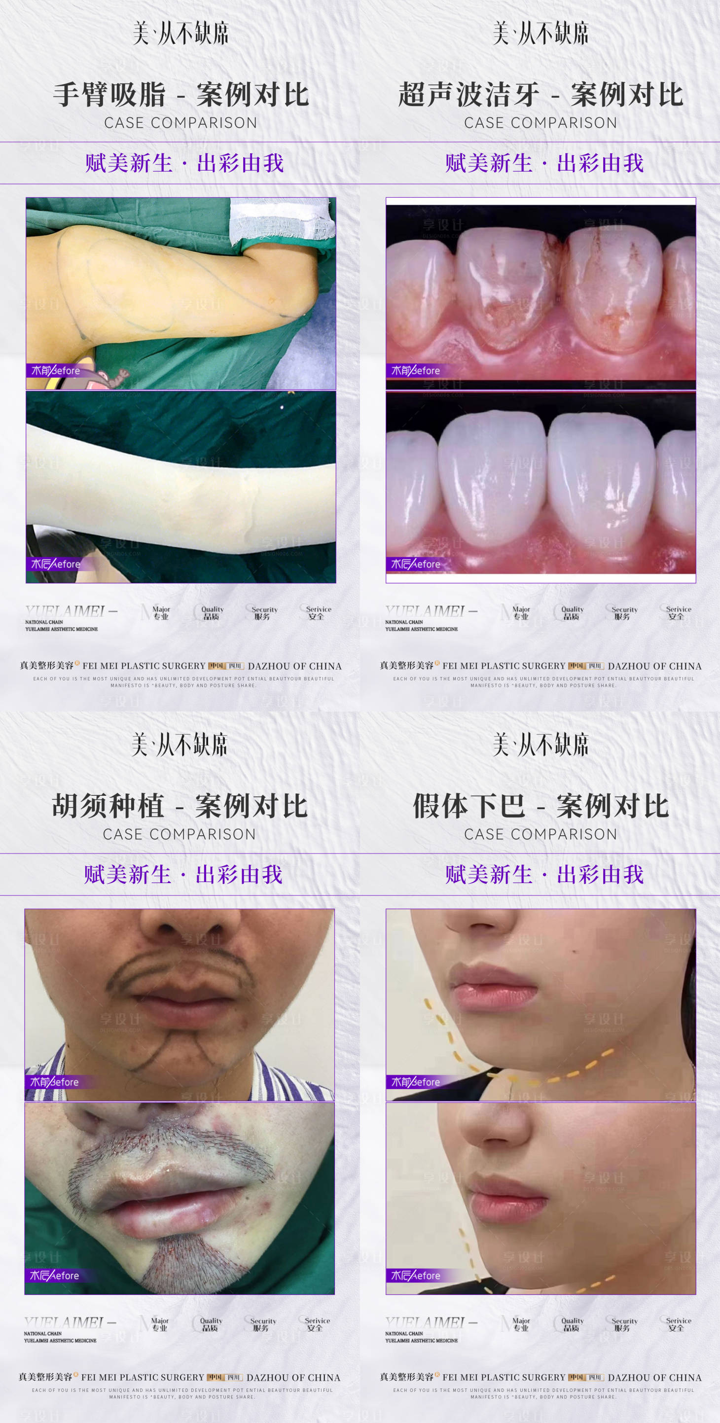 源文件下载【享设计】搜索编号：93670020027332013【医美整形简约案例对比】
