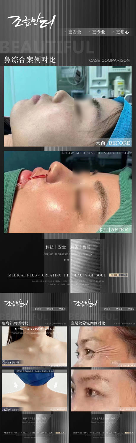 源文件下载【医美案例海报】编号：50070020154646634