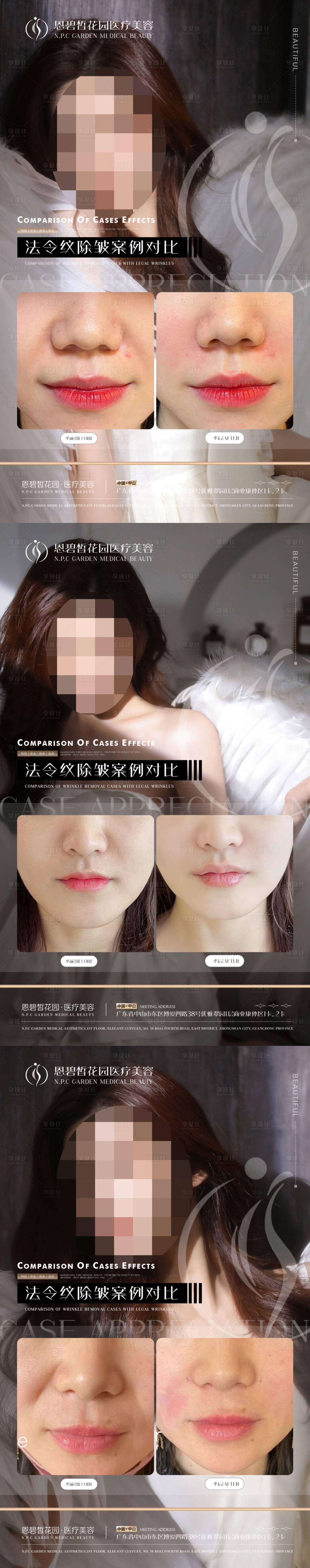 源文件下載【享設計】搜索編號：78030020613107338【醫美海報】