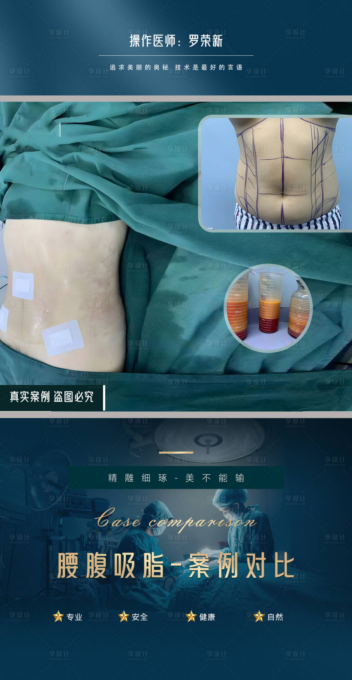 源文件下载【享设计】搜索编号：89280020642028446【医美腰腹抽脂案例海报】