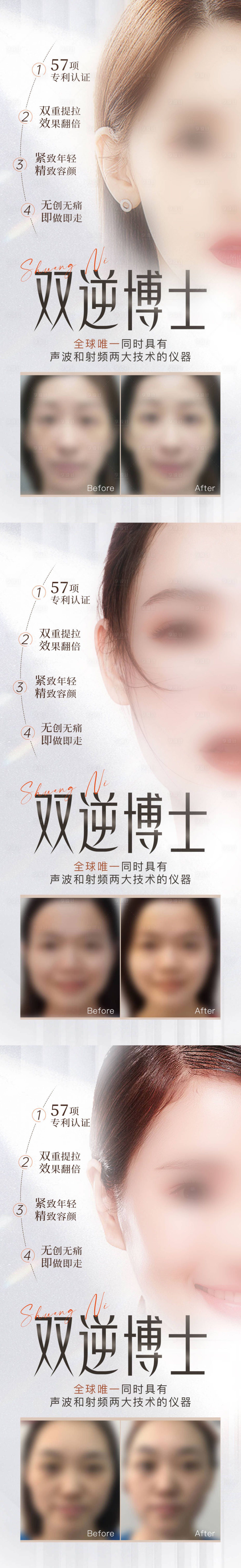 源文件下載【享設(shè)計(jì)】搜索編號(hào)：11270020565788381【醫(yī)美抗衰儀器案例海報(bào)】