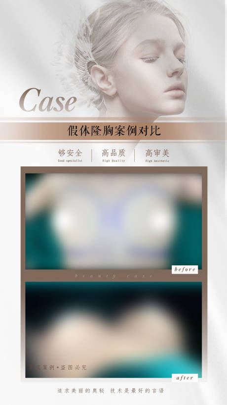 源文件下载【医美隆胸丰胸简约海报】编号：15940020556395847