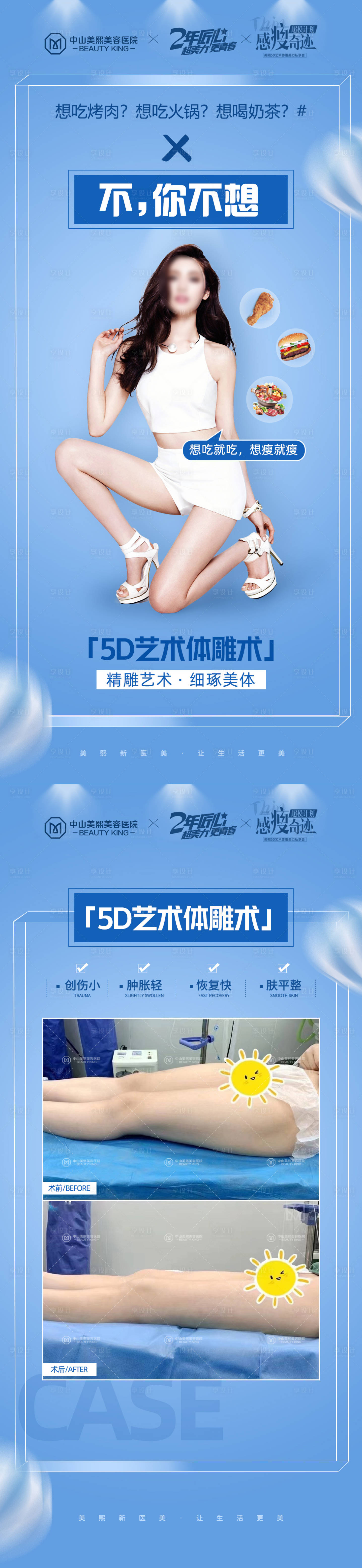 源文件下载【体雕吸脂助推海报】编号：95190020198695801