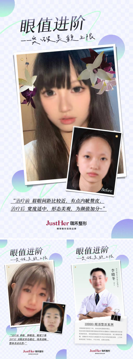 源文件下载【双眼皮案例对比海报】编号：74560020531102301