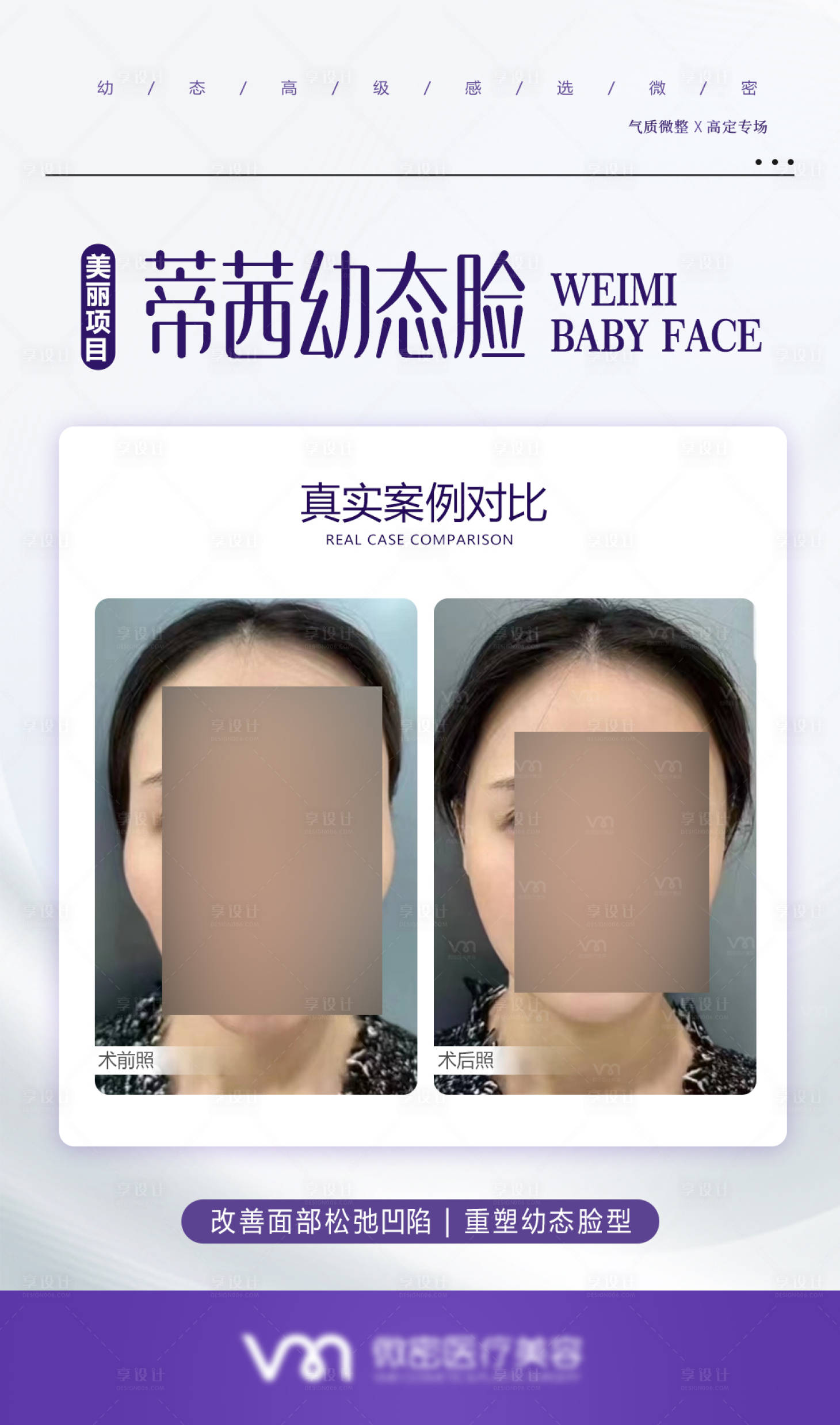 源文件下载【医美案例对比海报】编号：42640020185451838