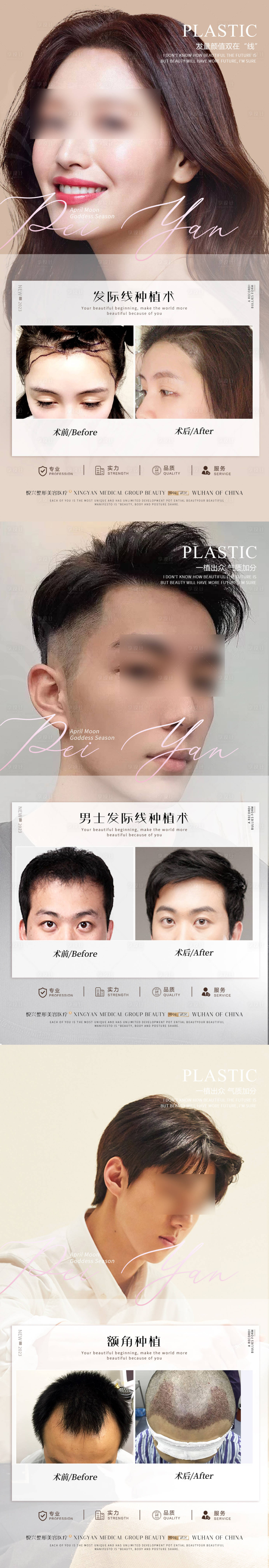 源文件下载【享设计】搜索编号：54120020307959344【植发案例】