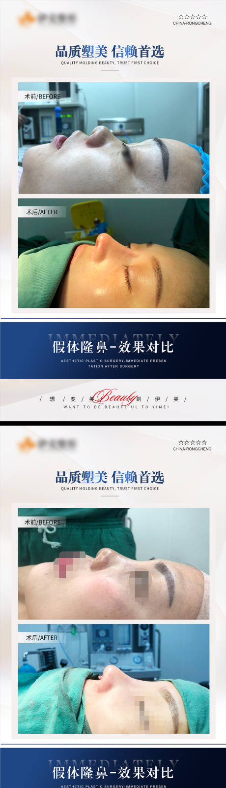 源文件下载【享设计】搜索编号：78630020219332314【医美案例模板对比HB 】