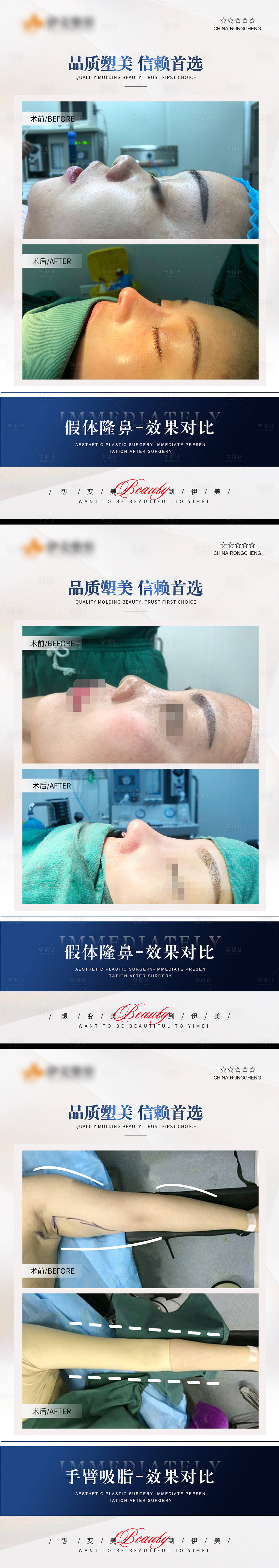源文件下載【享設(shè)計(jì)】搜索編號(hào)：78630020219332314【醫(yī)美案例模板對(duì)比HB 】