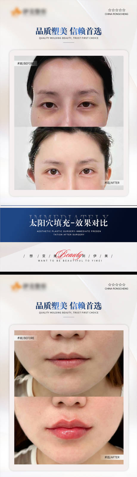 源文件下载【享设计】搜索编号：84820020465082807【医美案例模板对比】