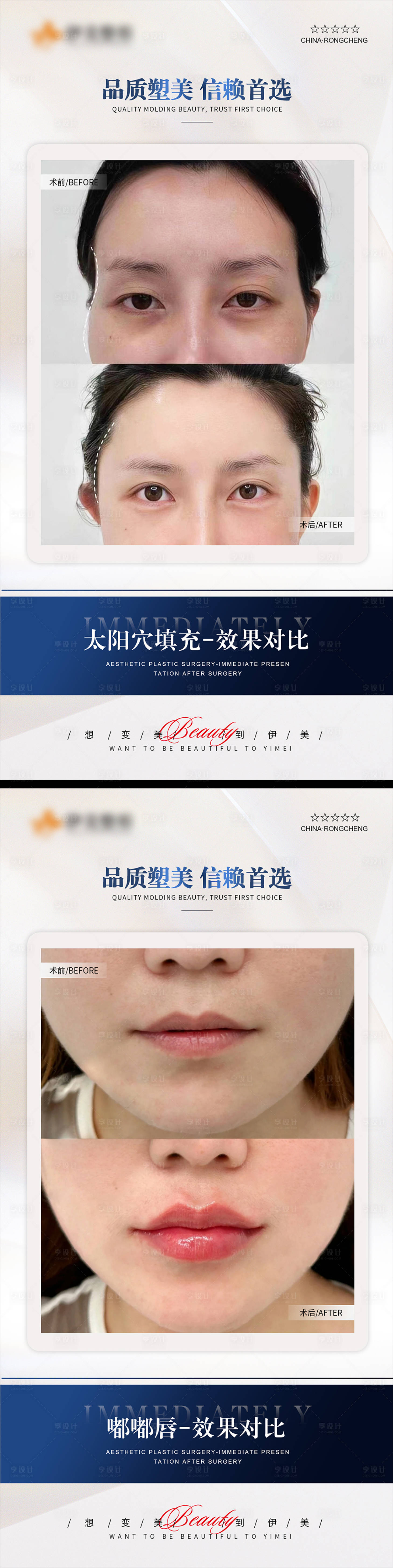 源文件下載【享設(shè)計】搜索編號：84820020465082807【醫(yī)美案例模板對比】