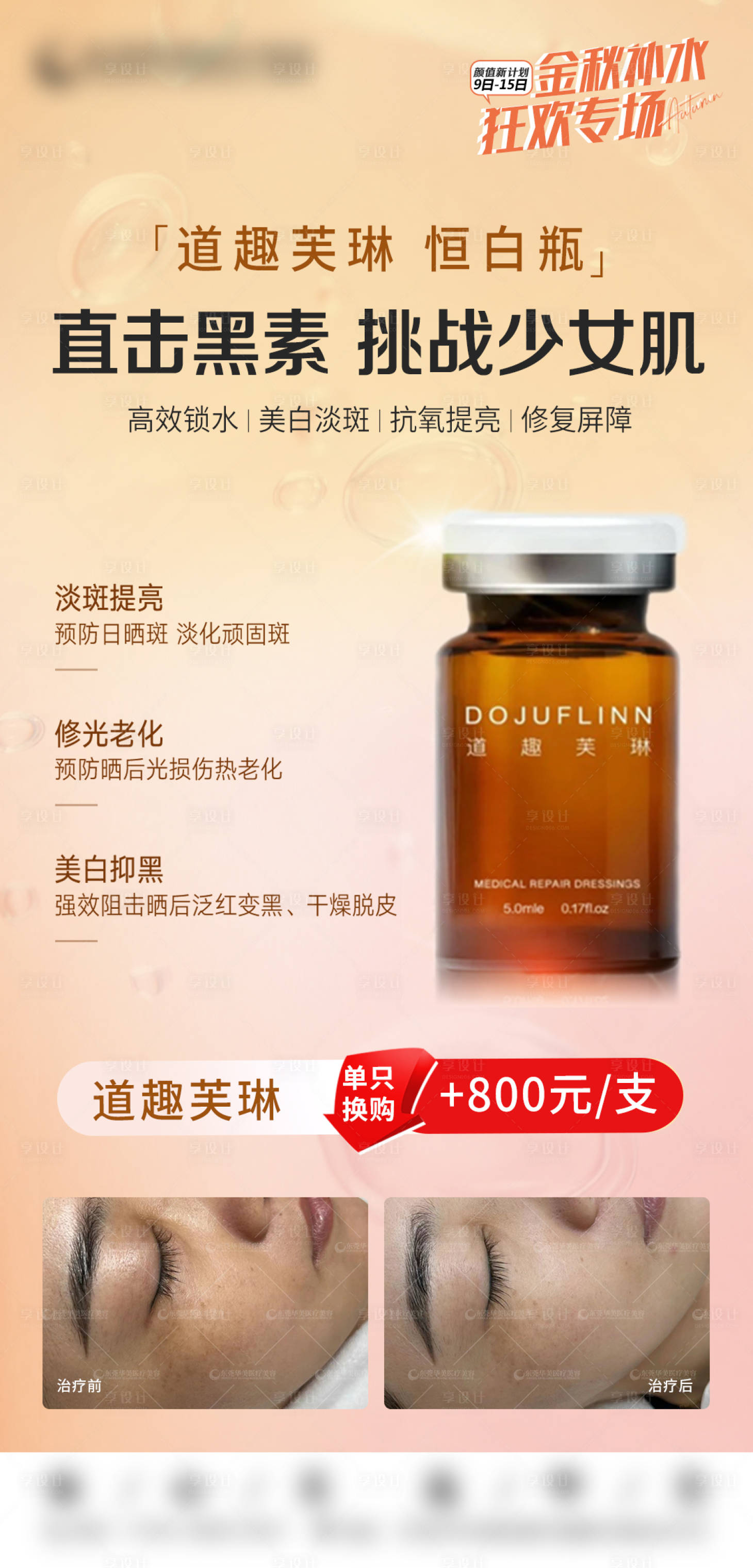 源文件下载【医美海报】编号：90950020205317239