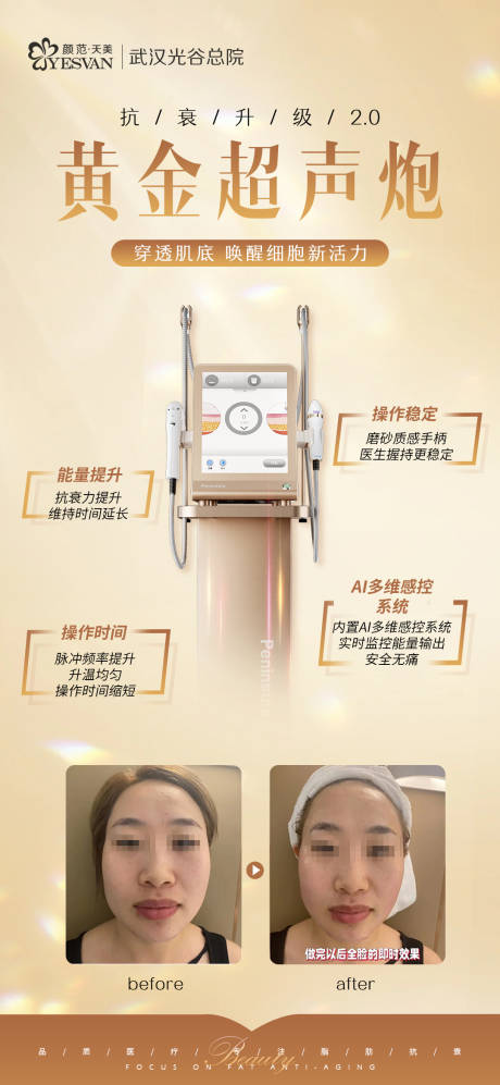 源文件下载【黄金超声炮海报】编号：27990020479211567
