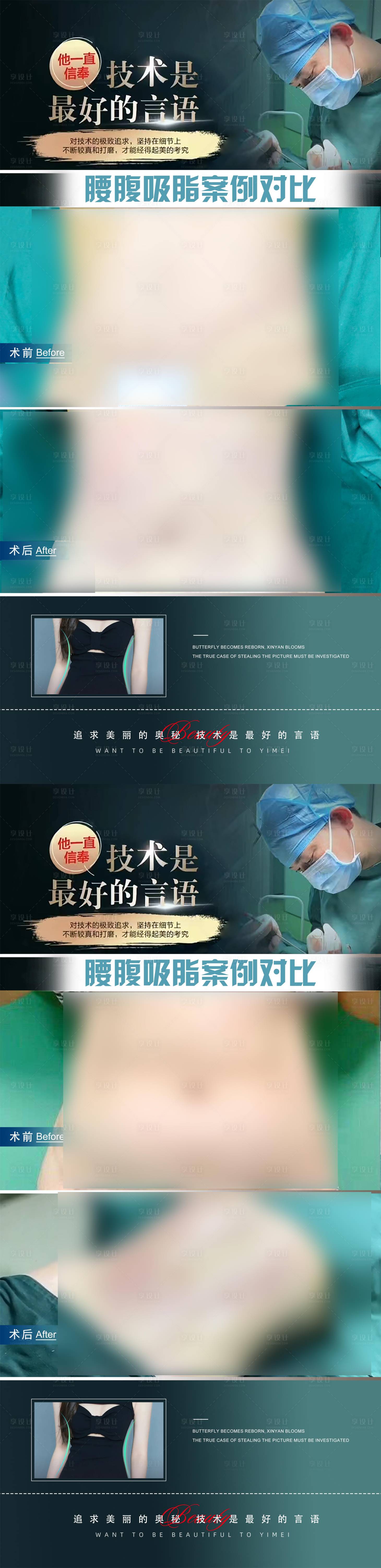 源文件下载【医美腰腹抽脂案例海报】编号：24360020541798490