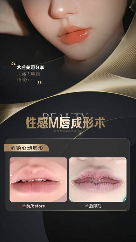 源文件下载【M唇案例海报】编号：47650020195356211