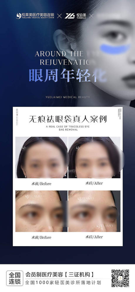 源文件下载【项目海报】编号：70610020415171999