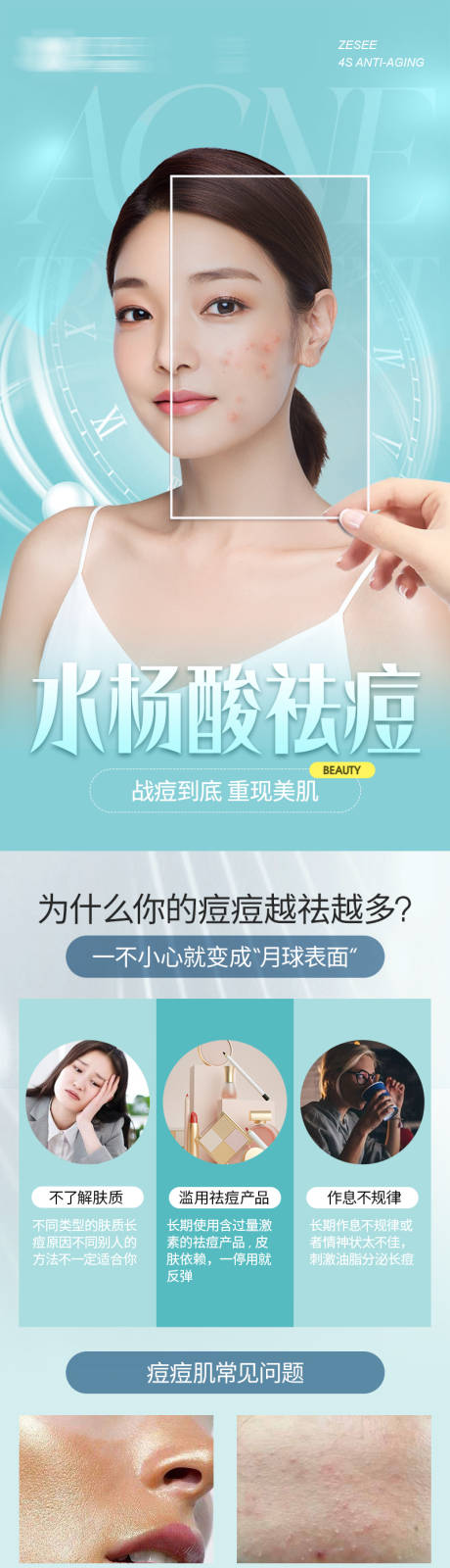 源文件下载【医美水杨酸祛痘详情页】编号：62370020187198264