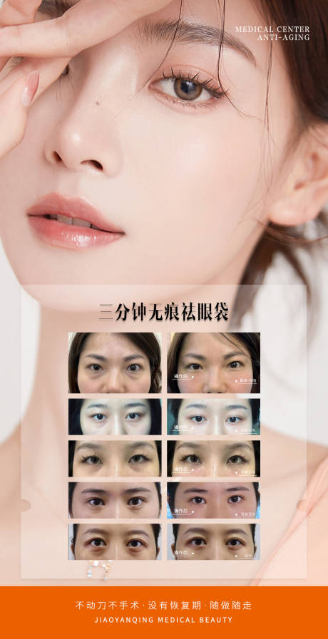 源文件下载【眼袋海报】编号：20370020412235874
