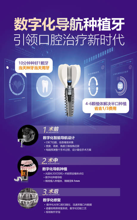 医疗口腔牙科数字化种植牙展架-源文件【享设计】