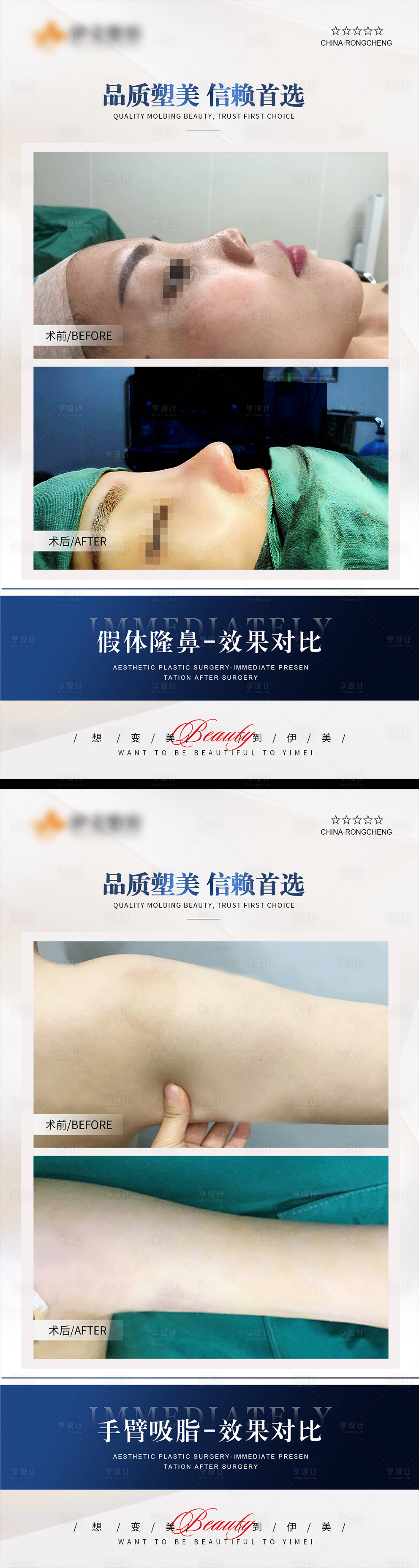 源文件下载【享设计】搜索编号：41290020207223259【医美案例模板对比海报】