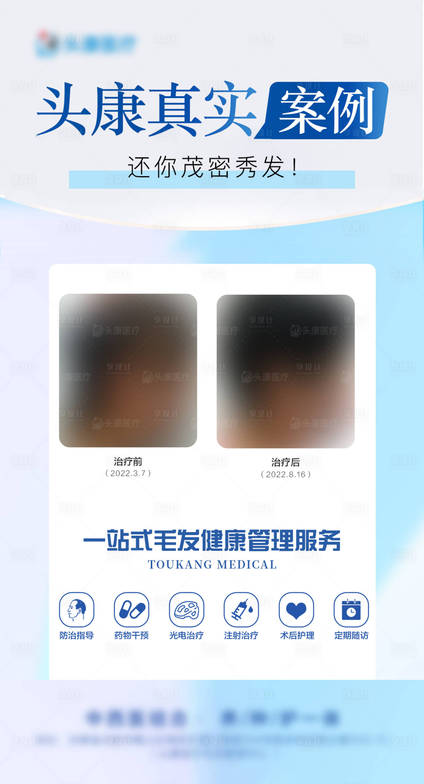 源文件下載【治療脫發(fā)案例海報】編號：52770020629506886