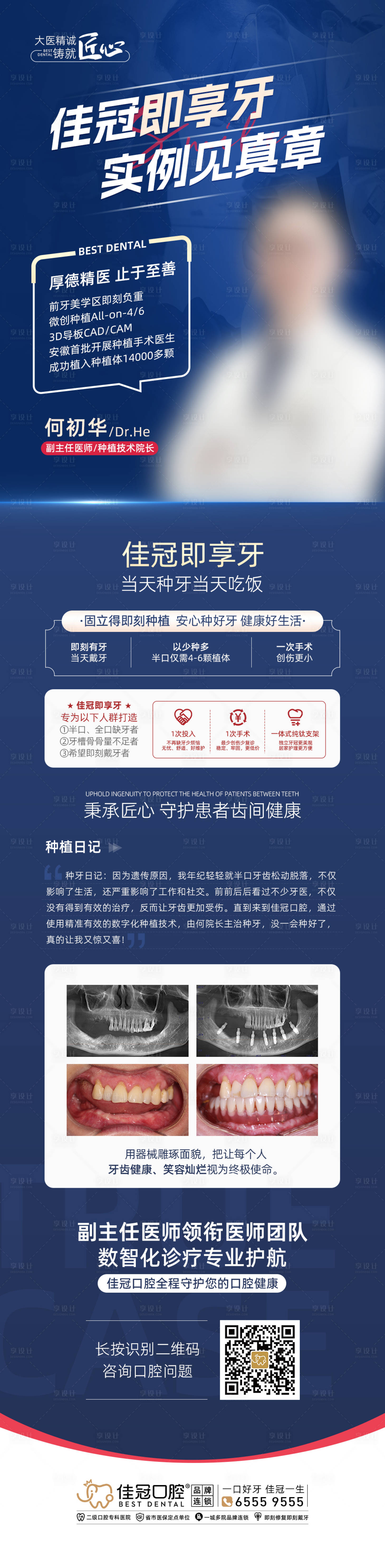 源文件下載【享設計】搜索編號：75790020239287265【種植牙案例分享】