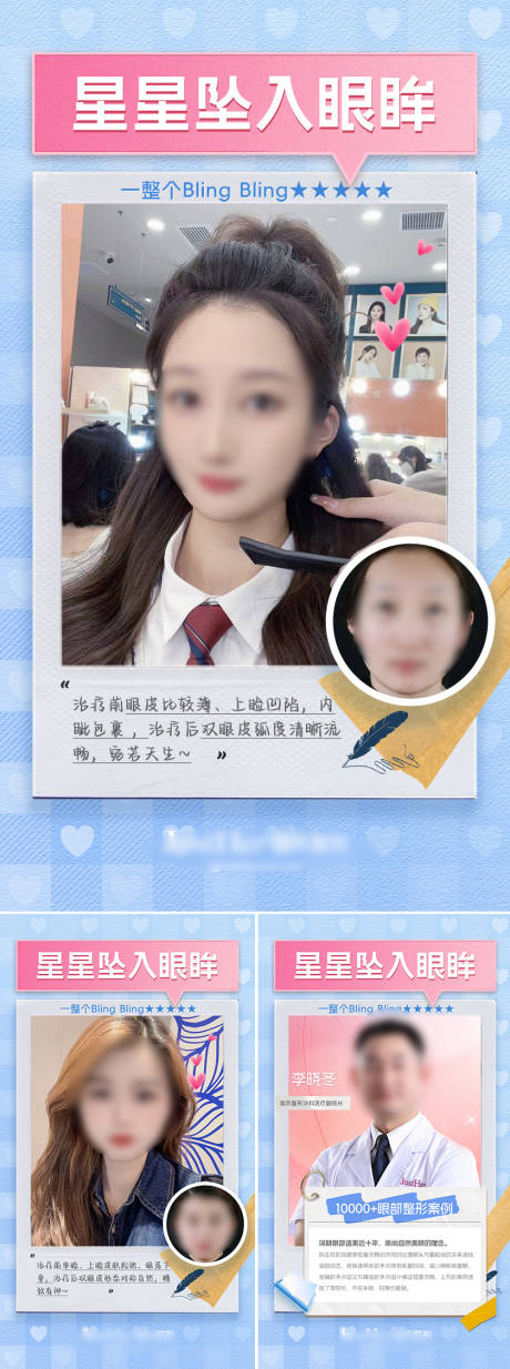 源文件下載【雙眼皮案例對比海報】編號：81190020152586731