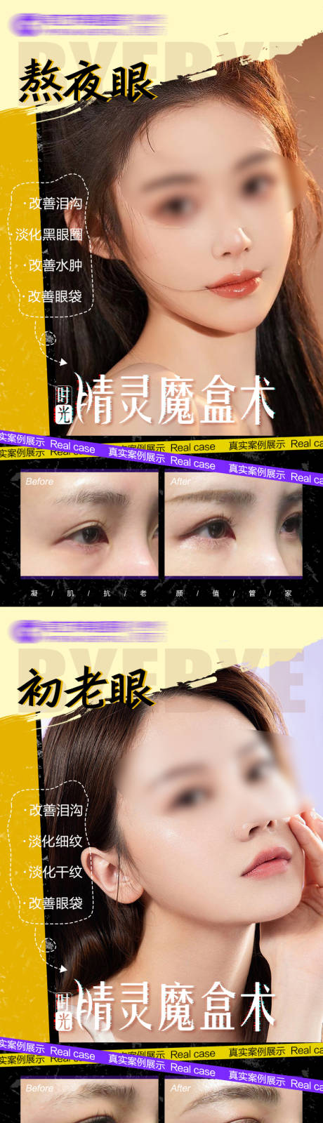 源文件下載【醫美睛靈魔盒產品系列海報】編號：46090020697664340