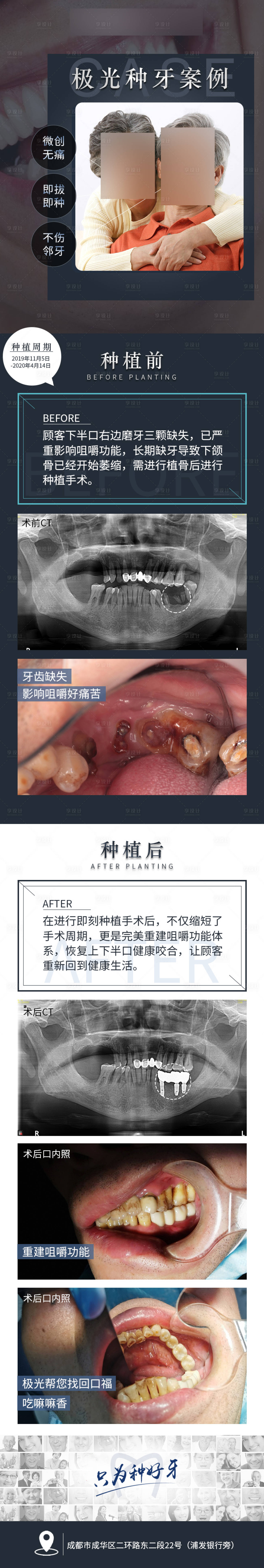 源文件下载【口腔活动详情页】编号：20231111091812326