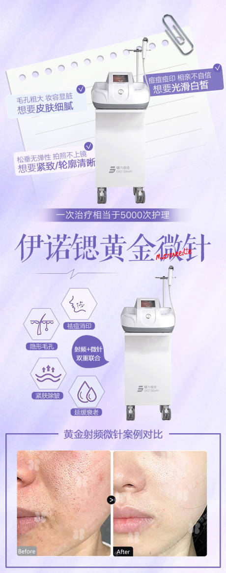 源文件下载【半岛黄金微针海报】编号：39710020253809661