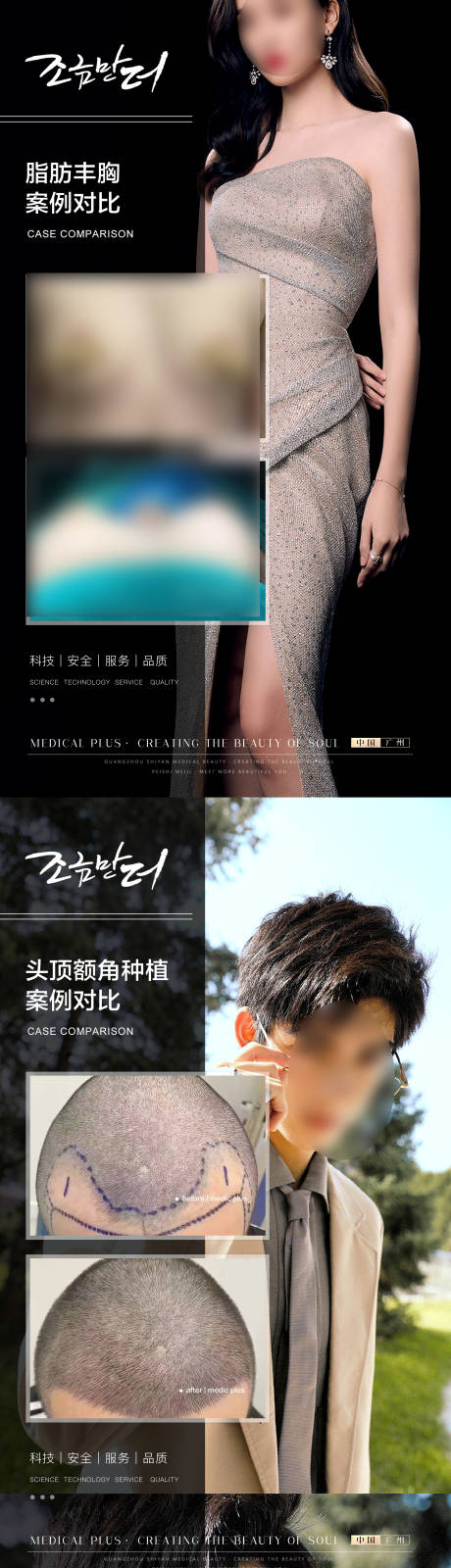 源文件下载【医美丰胸植发案例系列海报】编号：86180020238529945