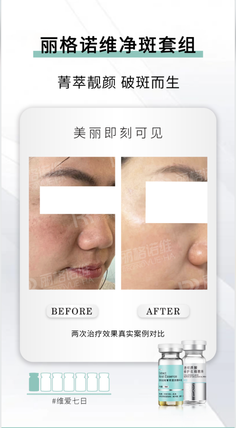 源文件下载【享设计】搜索编号：84570020430072492【丽格诺维对比图】