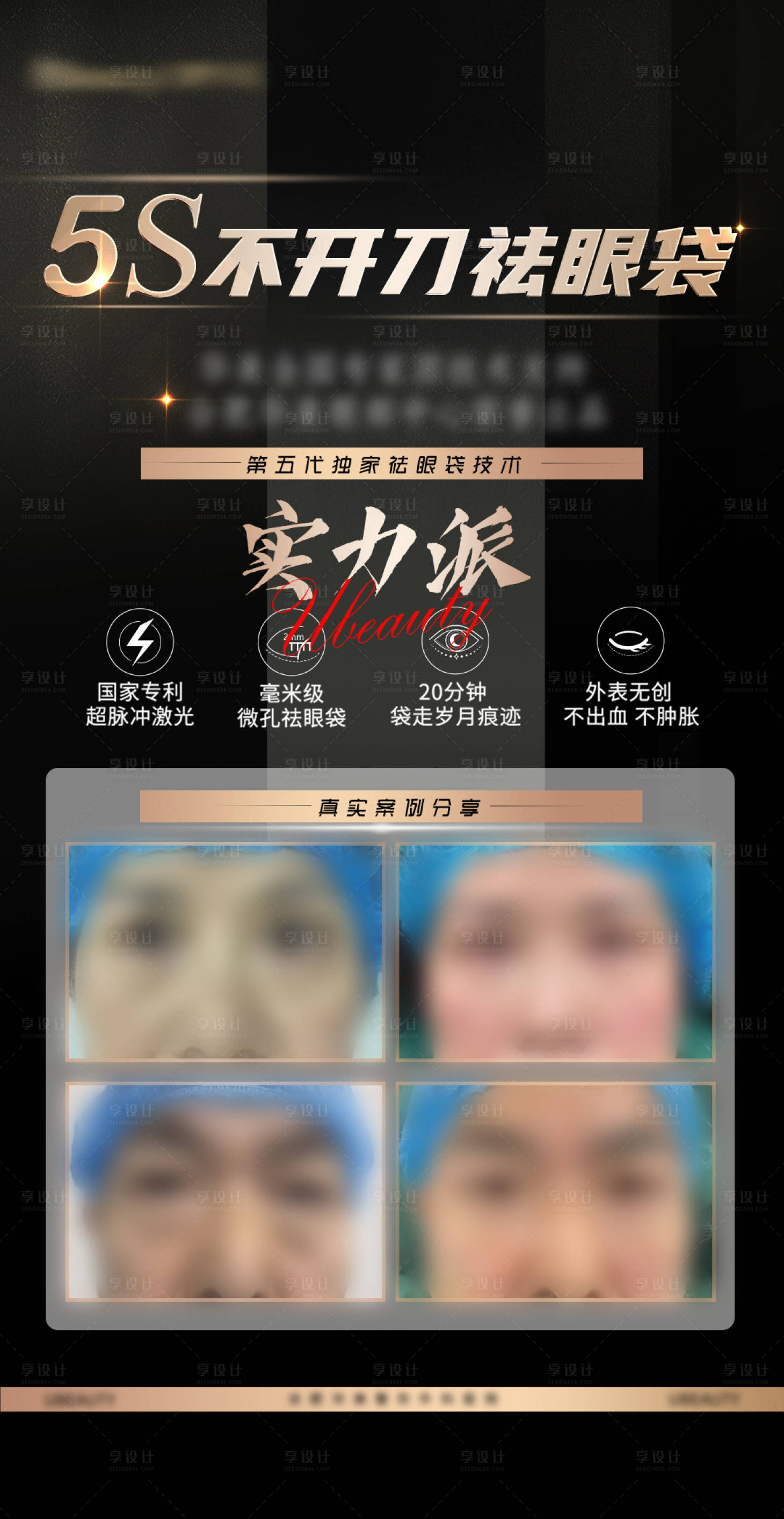 源文件下載【享設(shè)計(jì)】搜索編號(hào)：94730020312504833【不開刀祛眼袋 】