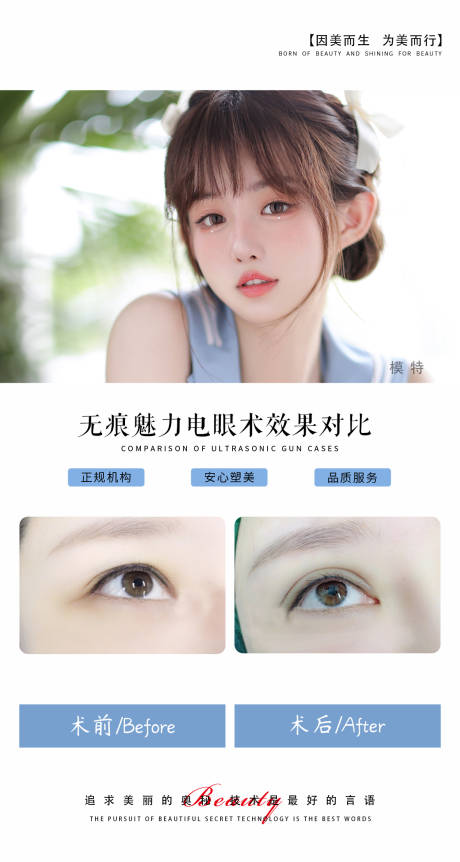 源文件下载【医美案例双眼皮】编号：73000020389906924