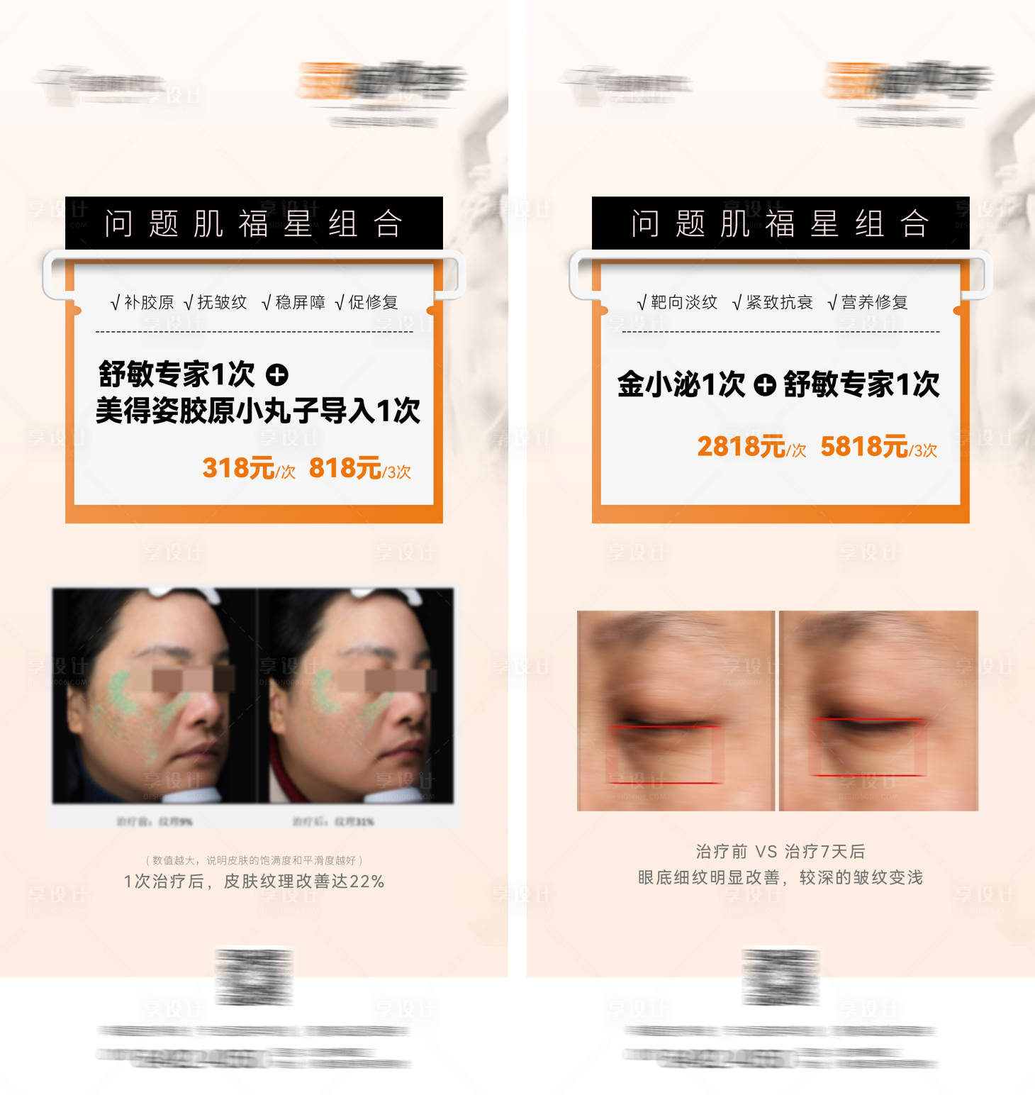 源文件下載【享設計】搜索編號：45470020191152581【醫美秒殺項目案例海報】