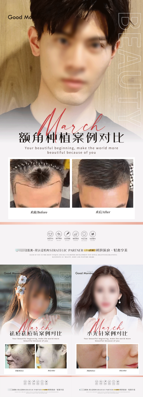 源文件下载【医美植发案例】编号：52270020681855327