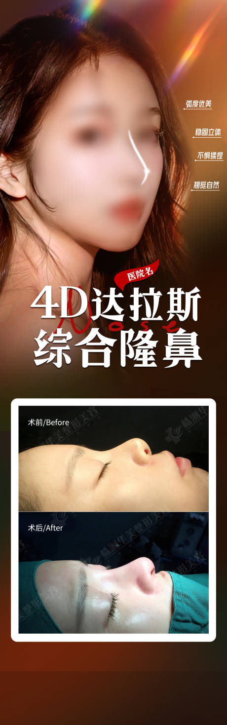 源文件下载【医美隆鼻案例海报】编号：53090020455864008