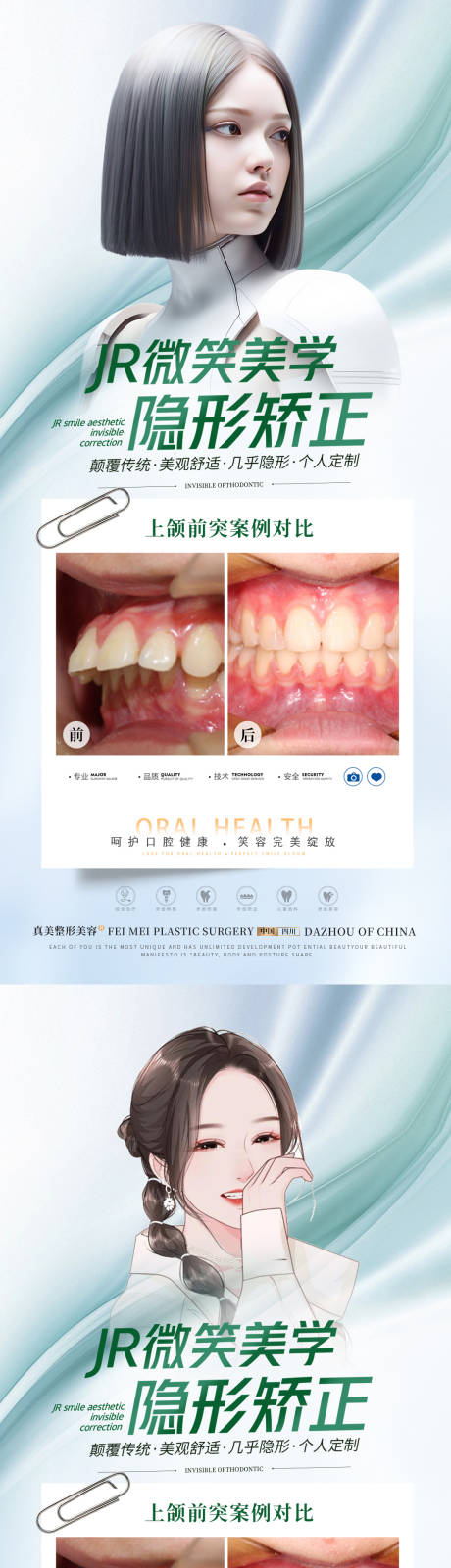 源文件下载【口腔上颌前突矫正海报】编号：20231129194234292