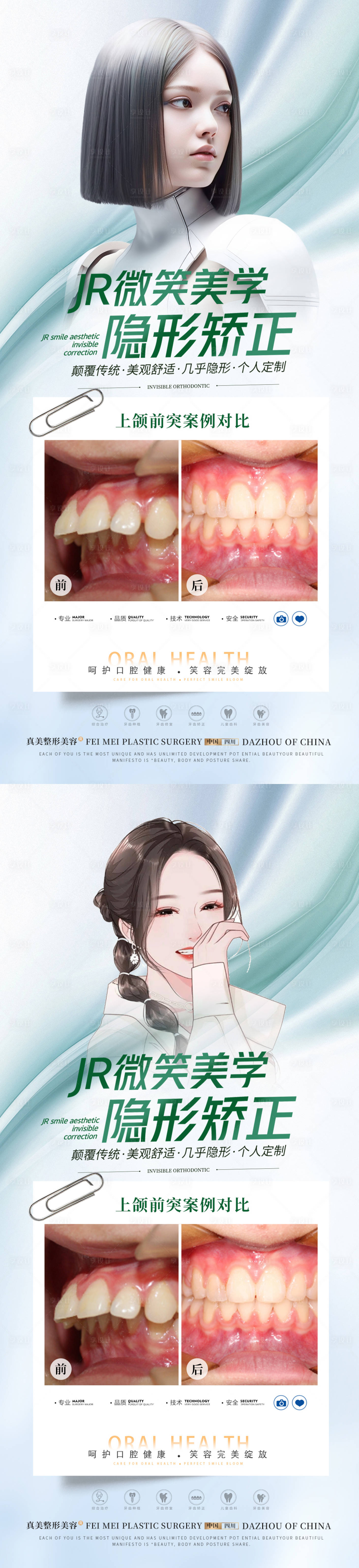 源文件下载【口腔上颌前突矫正海报】编号：76660020682029742