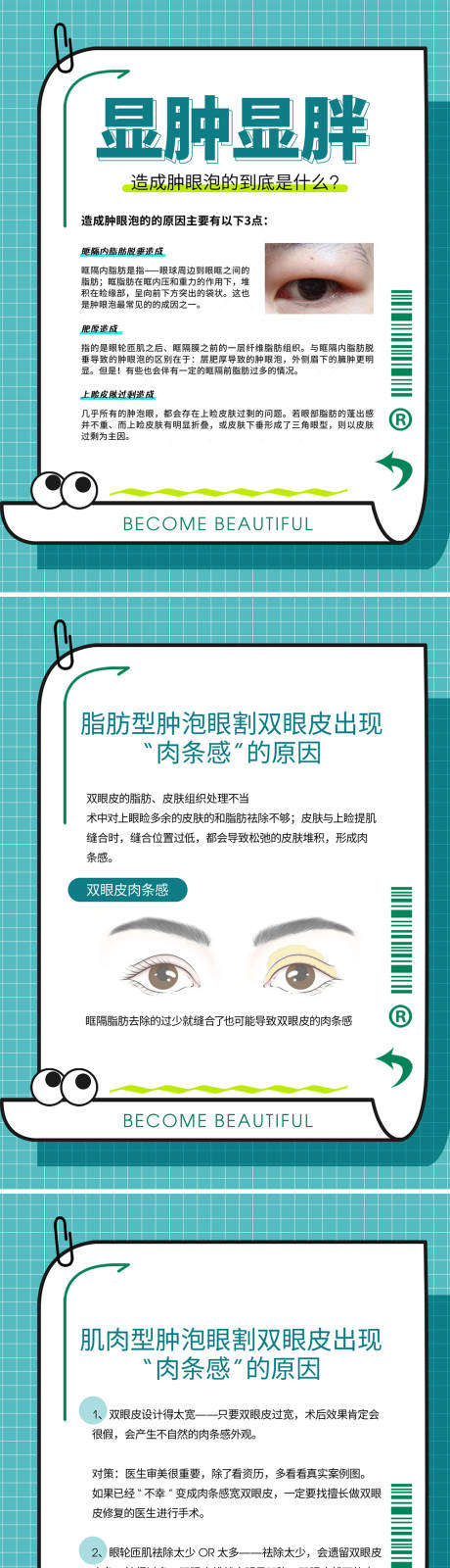源文件下載【醫美腫泡眼形成原因】編號：17480020313386372