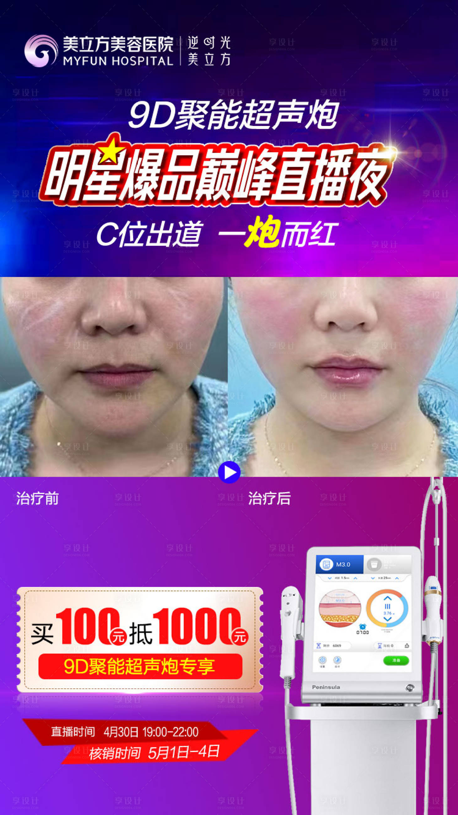 源文件下载【享设计】搜索编号：96790020668151506【医美直播明星夜案例对比海报】