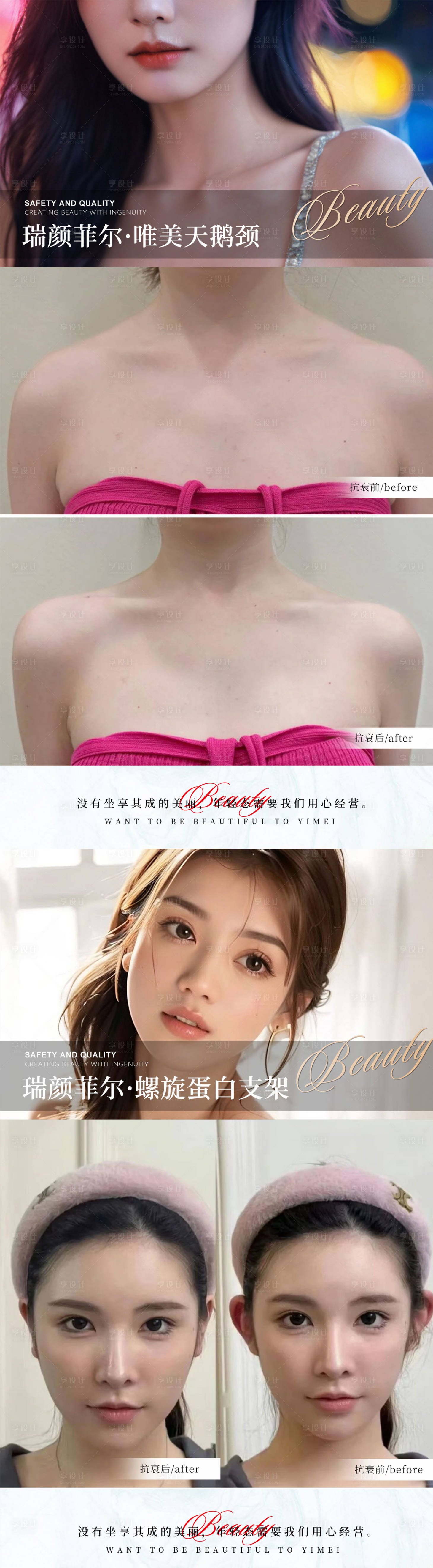 源文件下载【享设计】搜索编号：37610020179783952【抗衰案例】